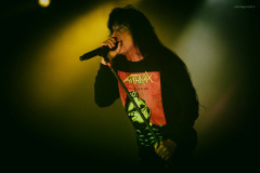 anthrax-15