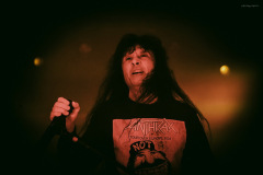 anthrax-171